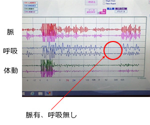 呼吸を止めた場合の波形の変化